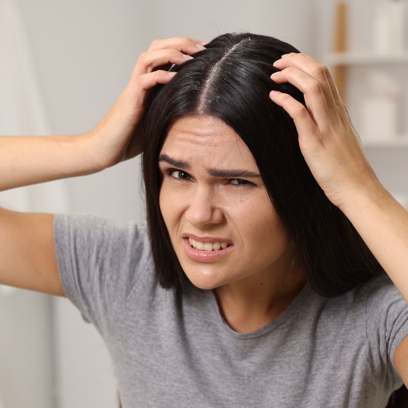 Лосион против пърхот - интензивна грижа за балансиран, чист и освежен скалп, 150 мл 1 Лосион еликсир против пърхот - интензивна грижа за балансиран, чист и освежен скалп, 150 мл